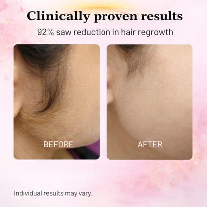 Cyperus Rotundus Oil